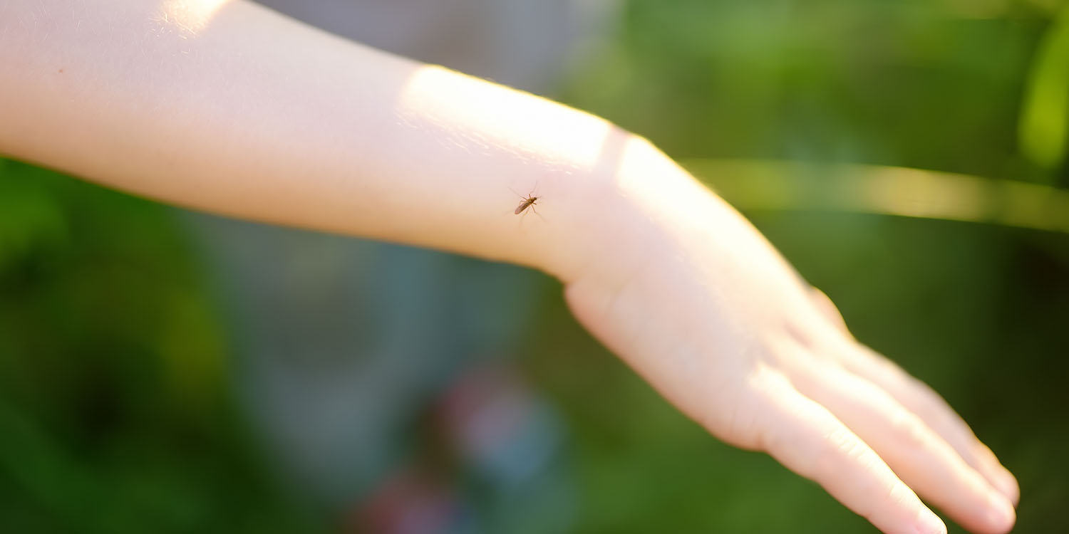 Herbal Pain Remedy for Bug Bites